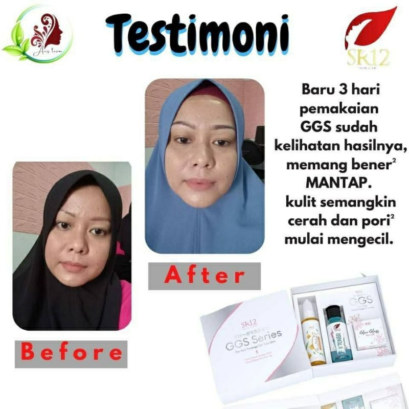 GGS SR12 / GLOW GLASS SKIN GEL / MENCERAHKAN KULIT WAJAH / RED GEL