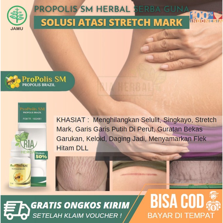Salep Untuk Penghilang Singkayo, Menghilangkan Stretch Mark / Garis Putih Di Tubuh, Bekas Korengan