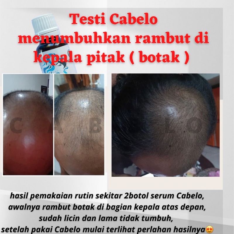 Serum rambut - Hair serum - Anti rontok || Serum rambut Cabelo penumbuh rambut ampuh-7