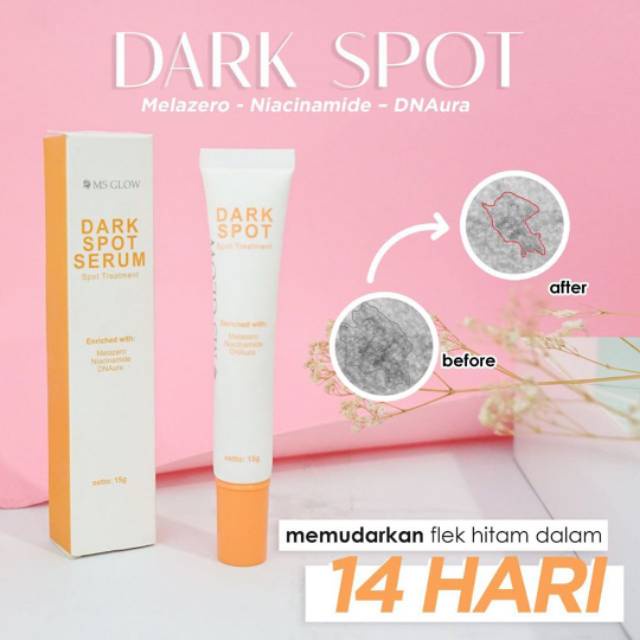 MS Glow Dark Spot Serum Treatment GIRLSNEED77 Membantu Memudarkan Bekas Jerawat dan Flek Hitam di Wajah