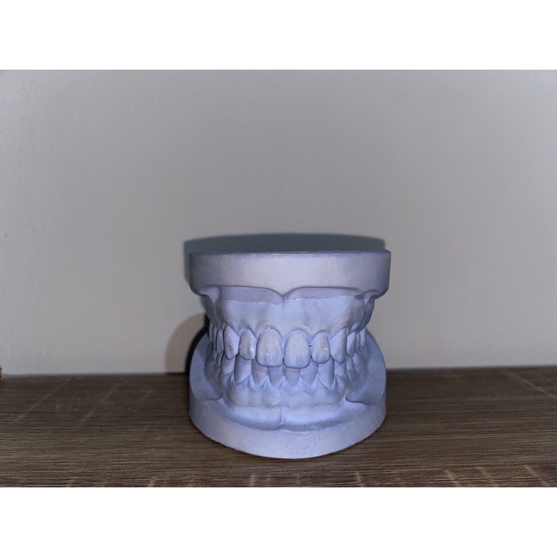 model study gips / model gigi praktikum gips