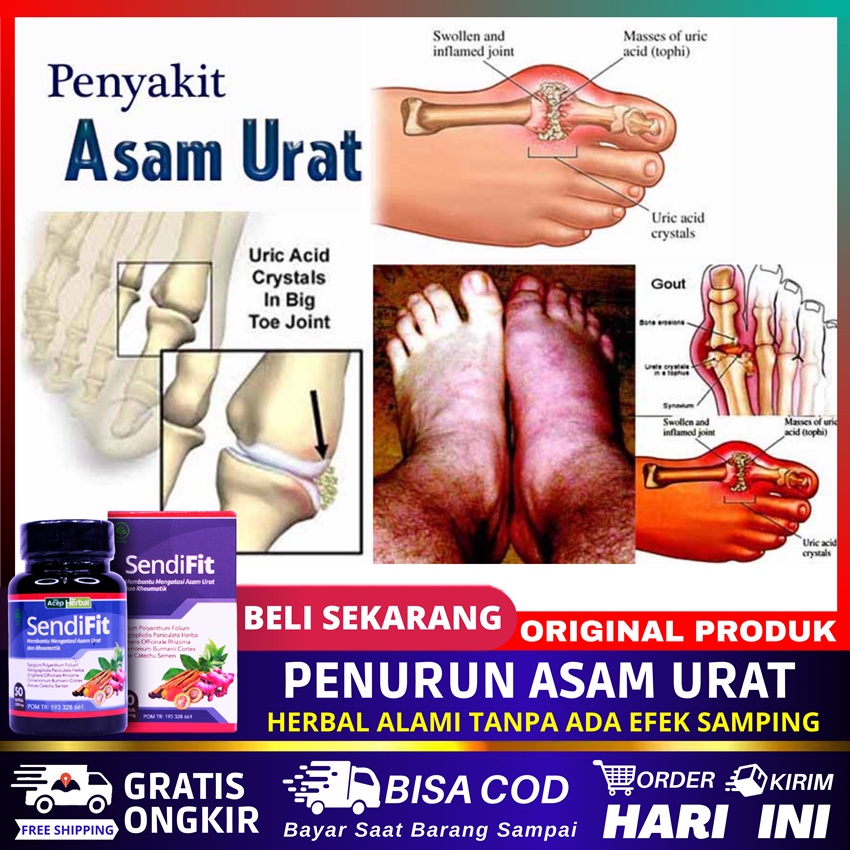 obat asam urat dan kolesterol nyeri sendi lutut sendifit no viostin ds