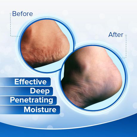 Dermal Heel Magic by Dermal Therapy 70g