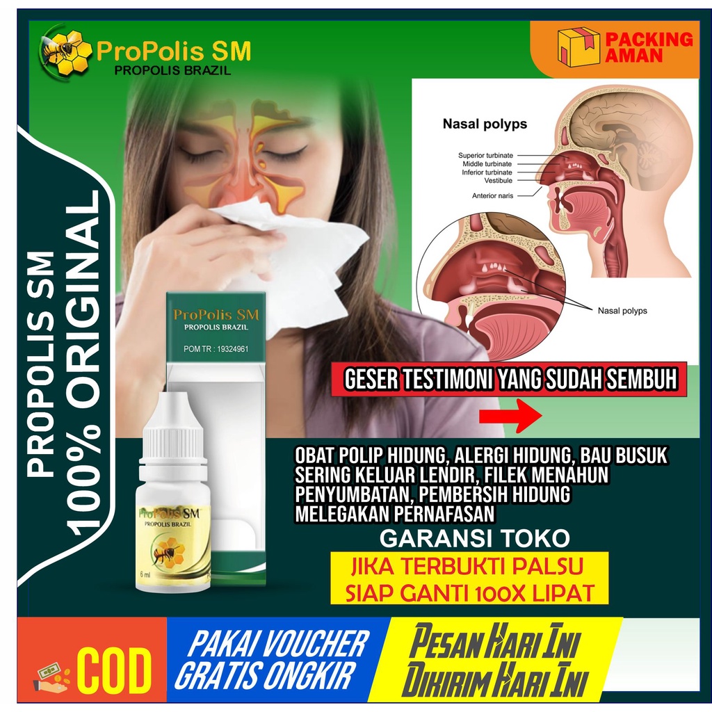 Obat Polip Hidung Alergi Hidung Sinusitis Infeksi Hidung Bau Busuk Filek Menahun Tersumbat Keluar Te