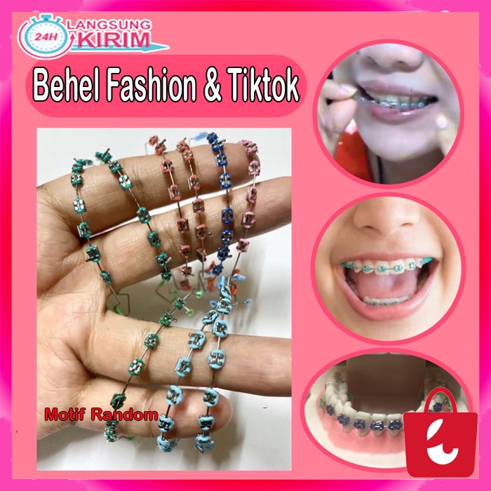 [Bisa COD] Behel Gigi Lepas Pasang Murah  Kawat Behel Warna Behel Atas Bawah Lepas Pasang Fashion Aneka Motif Cantik