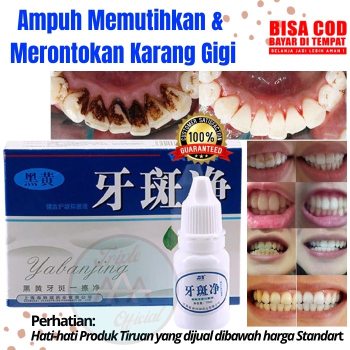 ORIGINAL 100% YABANJING PEMUTIH PEMBERSIH GIGI KUNING PENGHILANG PERONTOK KARANG GIGI 100% AMAN MANJUR TERBUKTI WHITENING TEETH ODOL CAIRAN CREAM