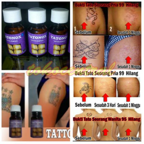 Pembersih Tato Penghilang Tatto Tatonox Penghilang Tato Cairan Penghilang Tato Obat Penghilang Tato
