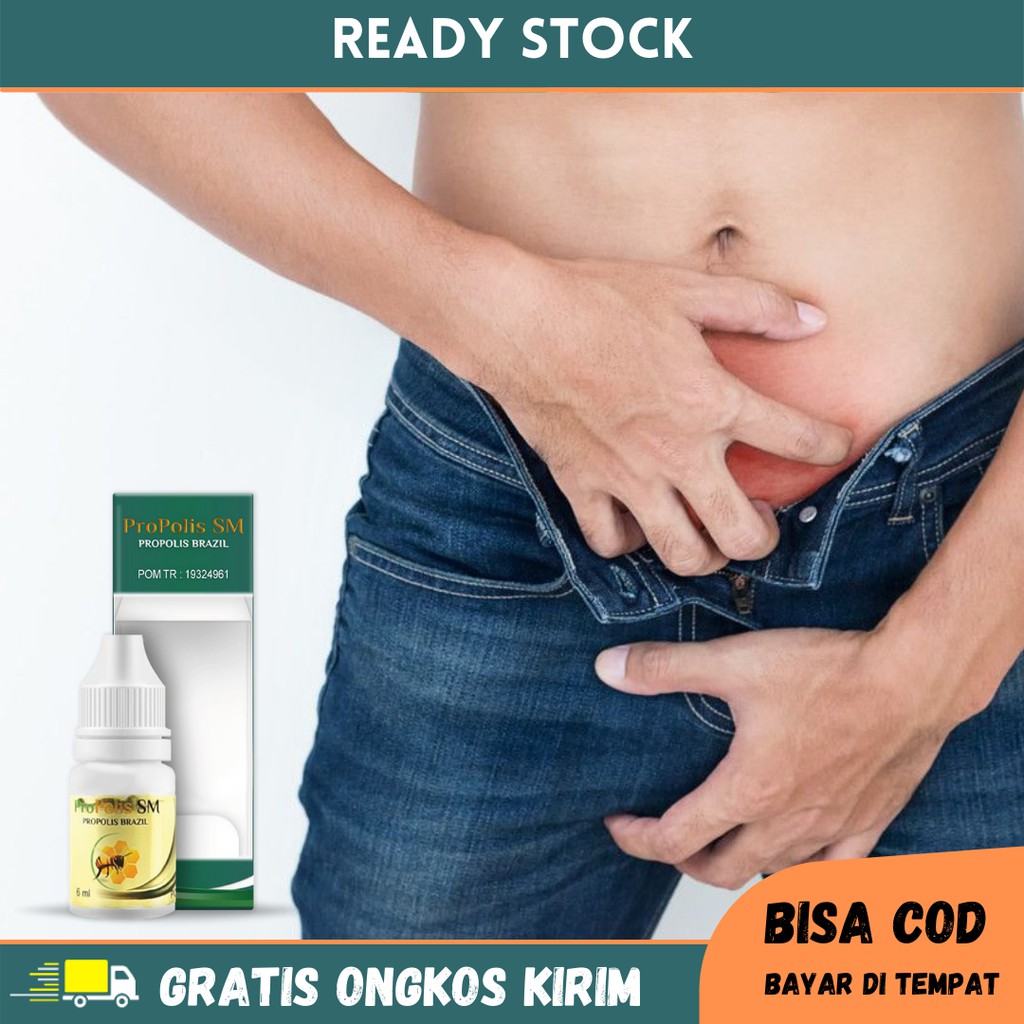 Obat Penis Lecet, Penis Gatal, Penis Perih, Ruam Merah Di Penis, Penis Keluar Nanah - Propolis SM