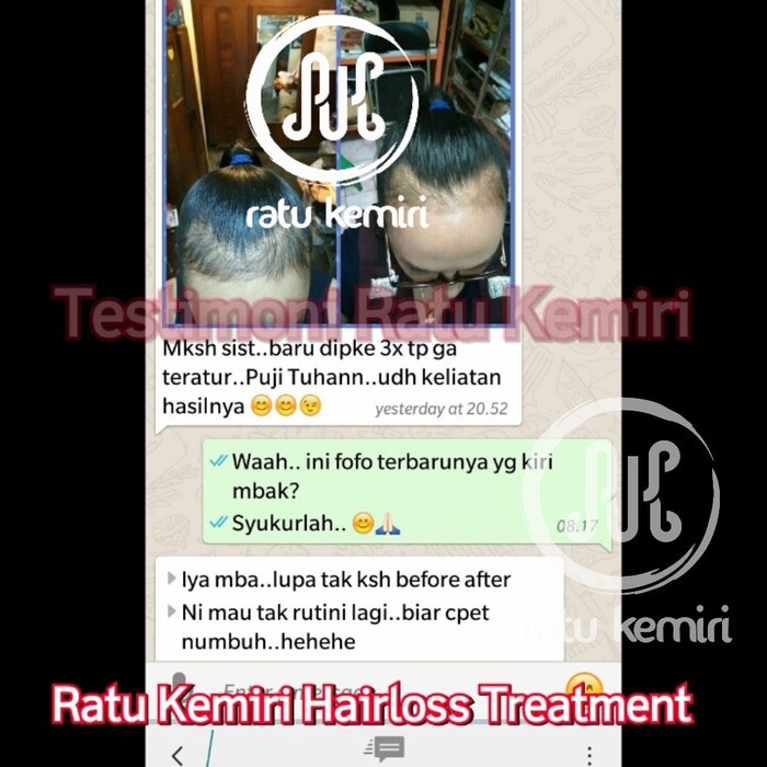DISKON!! PAKET HEMAT PERAWATAN RAMBUT RONTOK ALAMI RATU KEMIRI STYLING RAMBUT