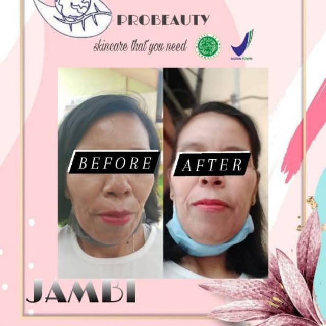 Skincare probeauty AHA