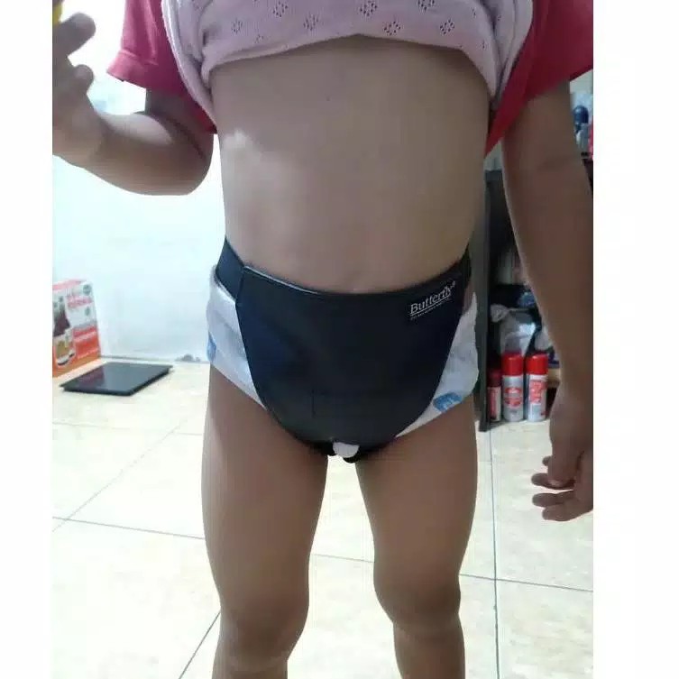 Celana Hernia Anak Balita Bayi Laki Perempuan