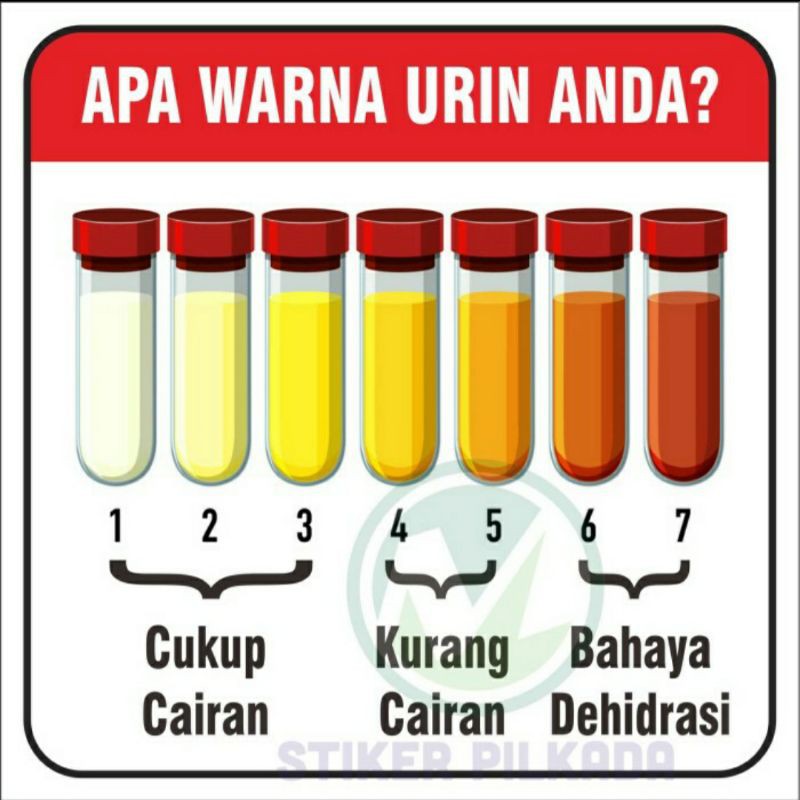 

STIKER VINYL TABEL WARNA URINE 15X15CM