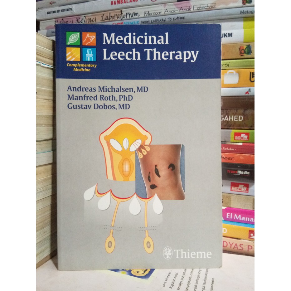 Medicinal Leech Therapy