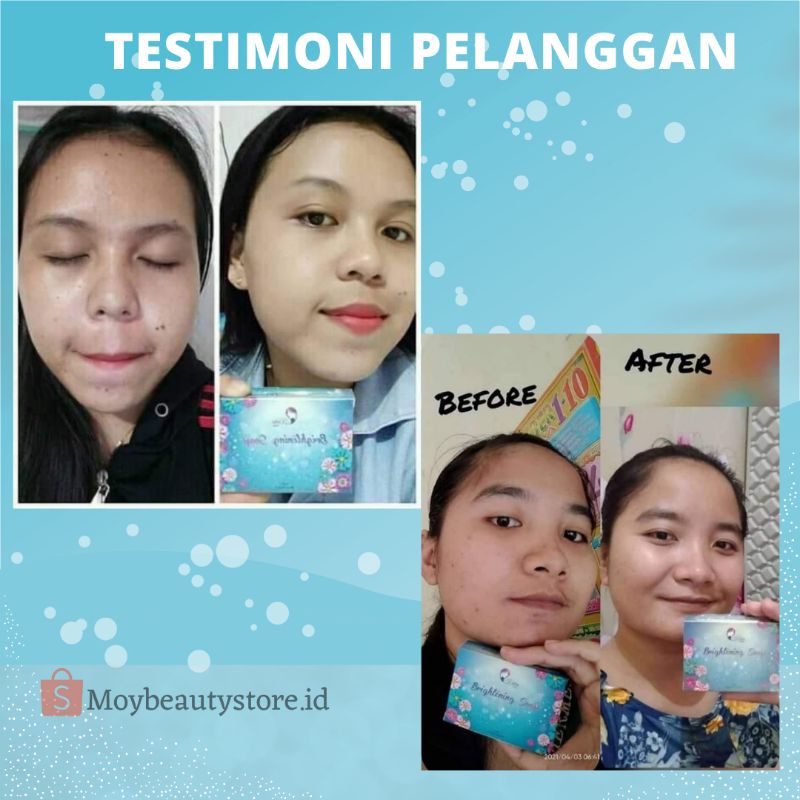 [ORIGINAL] SABUN KEDAS BEAUTY /KEDAS BEAUTY ORIGINAL BRIGHTENING SOAP KEDAS BEAUTY-3