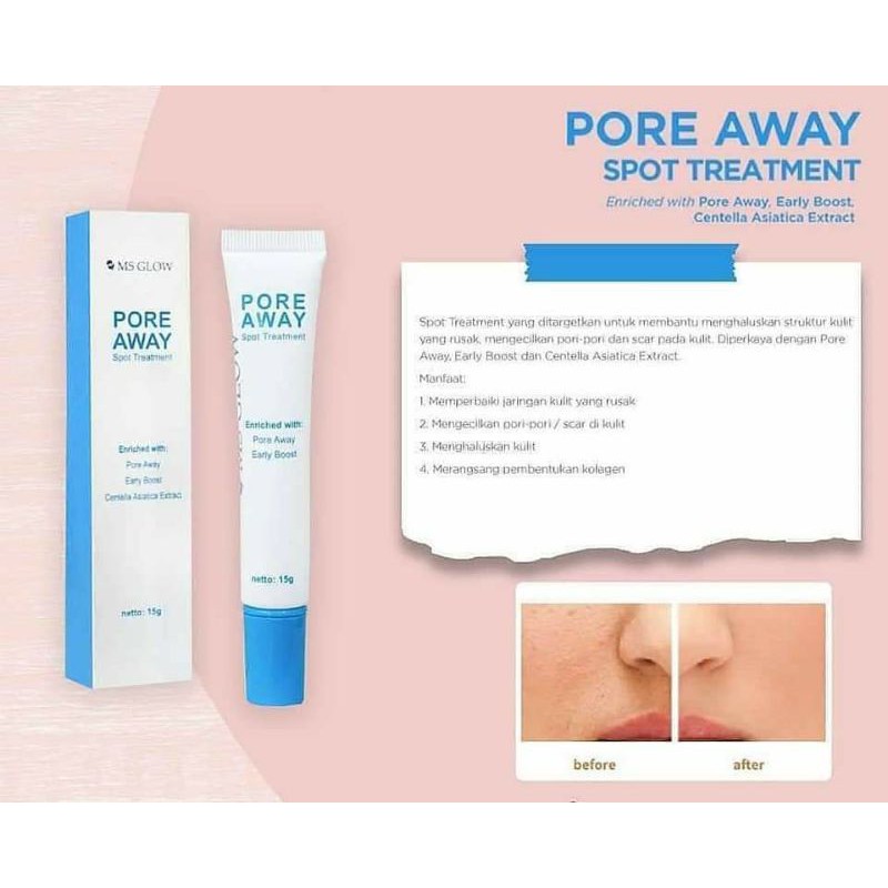 PORE AWAY MSGLOW (Untuk Bopeng)