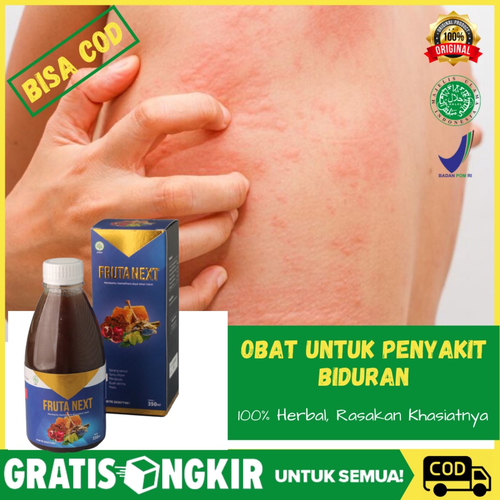 FRUTANEXT Obat Biduran Gatal-Gatal Eksim Alergi Dingin gatel Gatel Exim Eksim Fruta Next