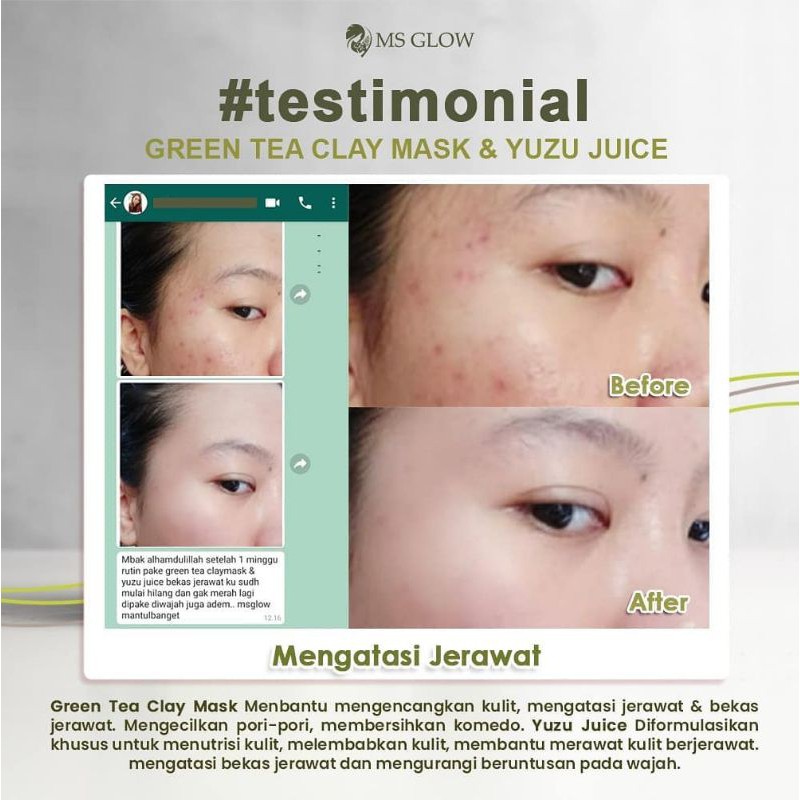 

greenteaclaymaskmsglow