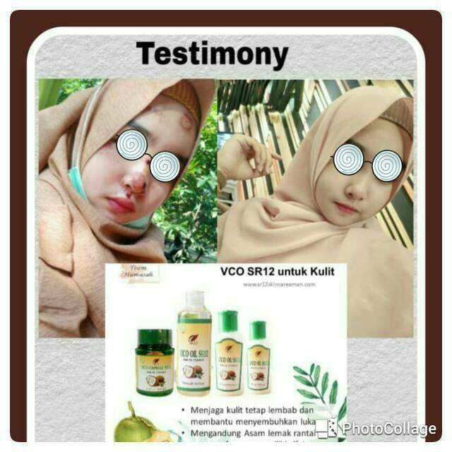 

BEST SELLER DAN ASLI Minyak kelapa murni atau VCO Oil sr12/Virgin Coconut Oil minyak mpasi bayi