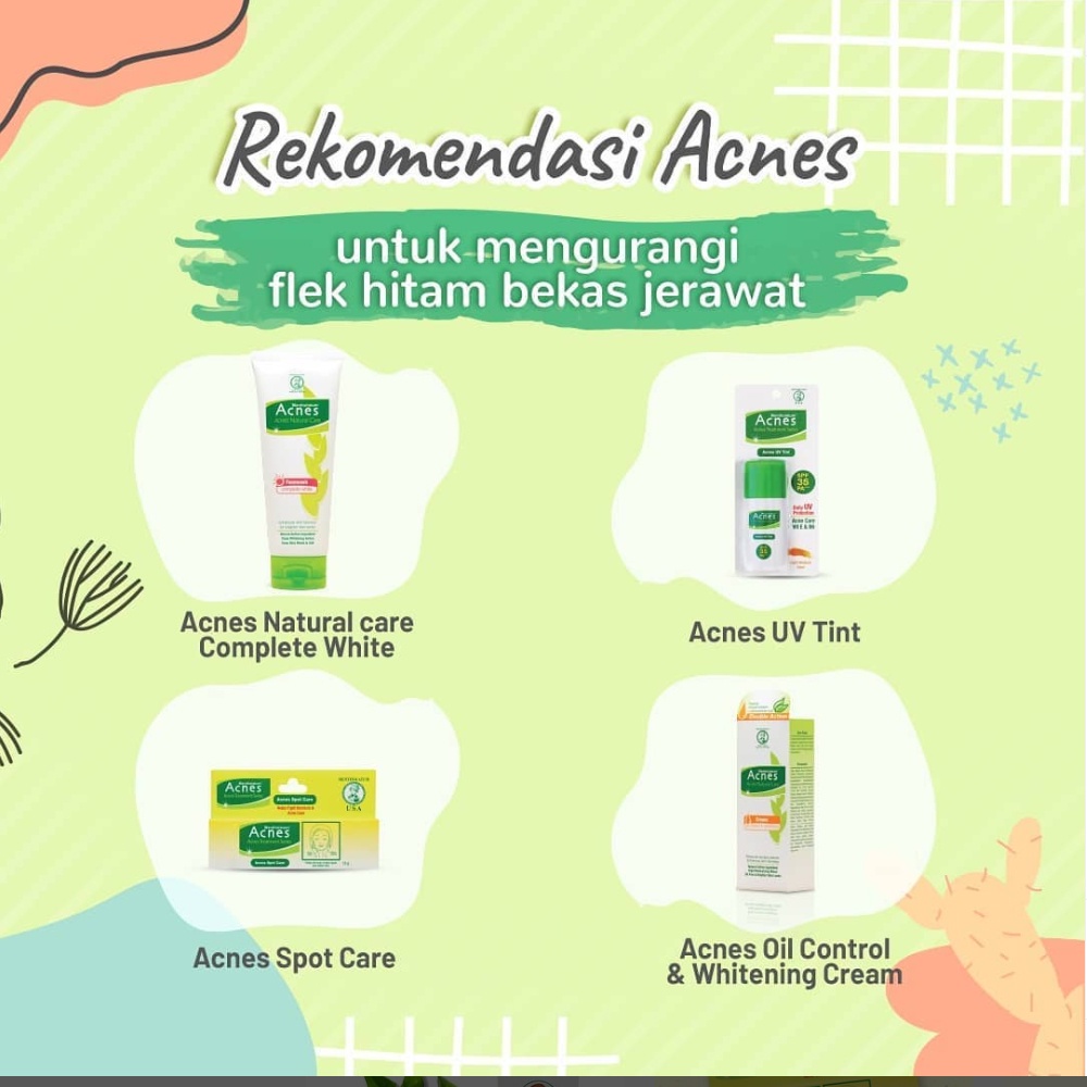 Acnes Natural Care Treatment Series mengatasi jerawat