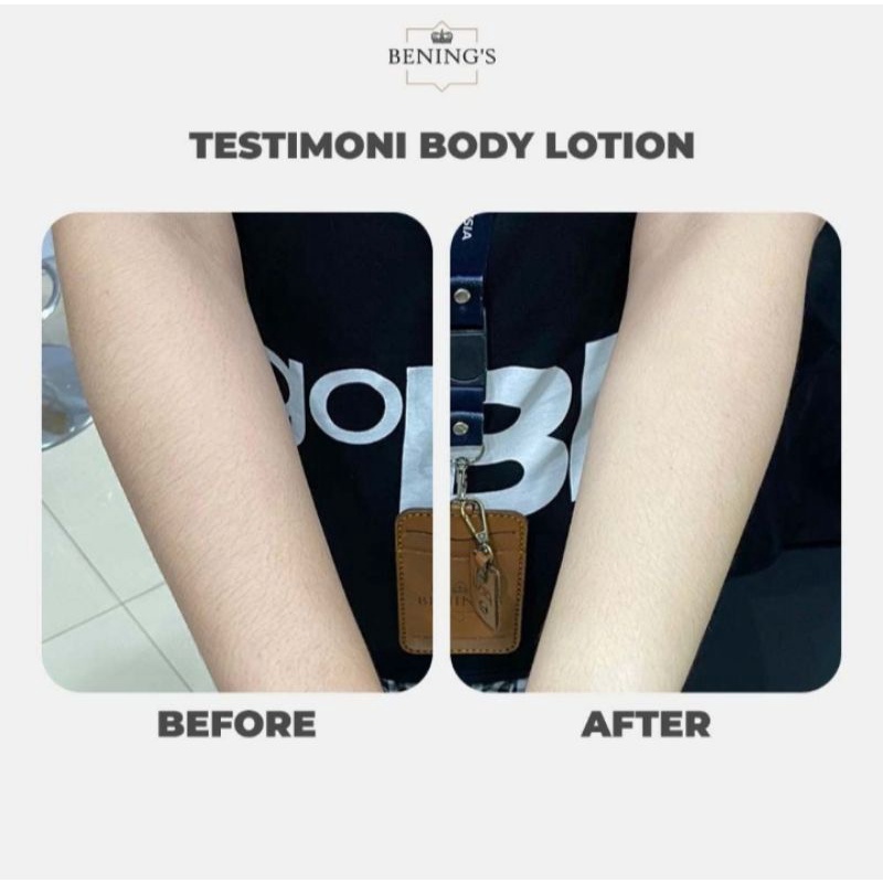 Body Lotion Benings Skincare Benings Chroma Body Lotion Serum