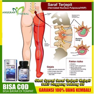 obat sakit pinggang sebelah kiri sampai ke paha 3