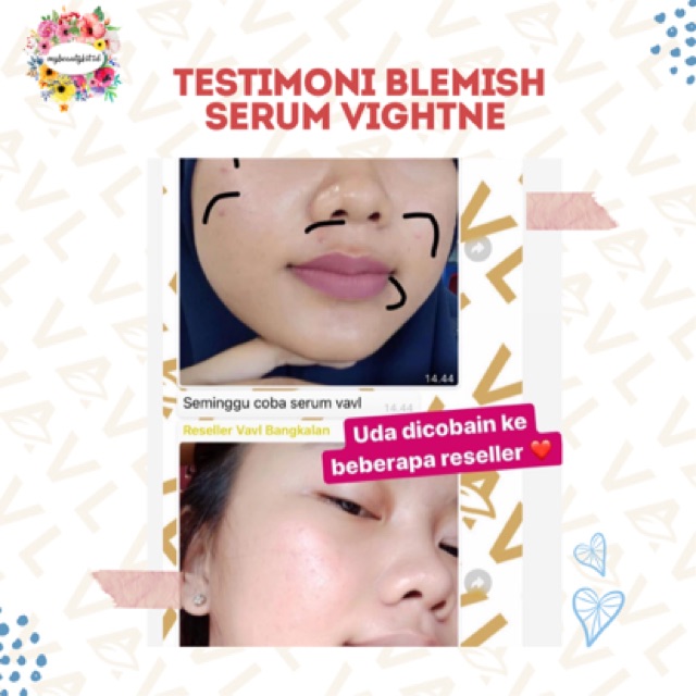 harga blemish serum