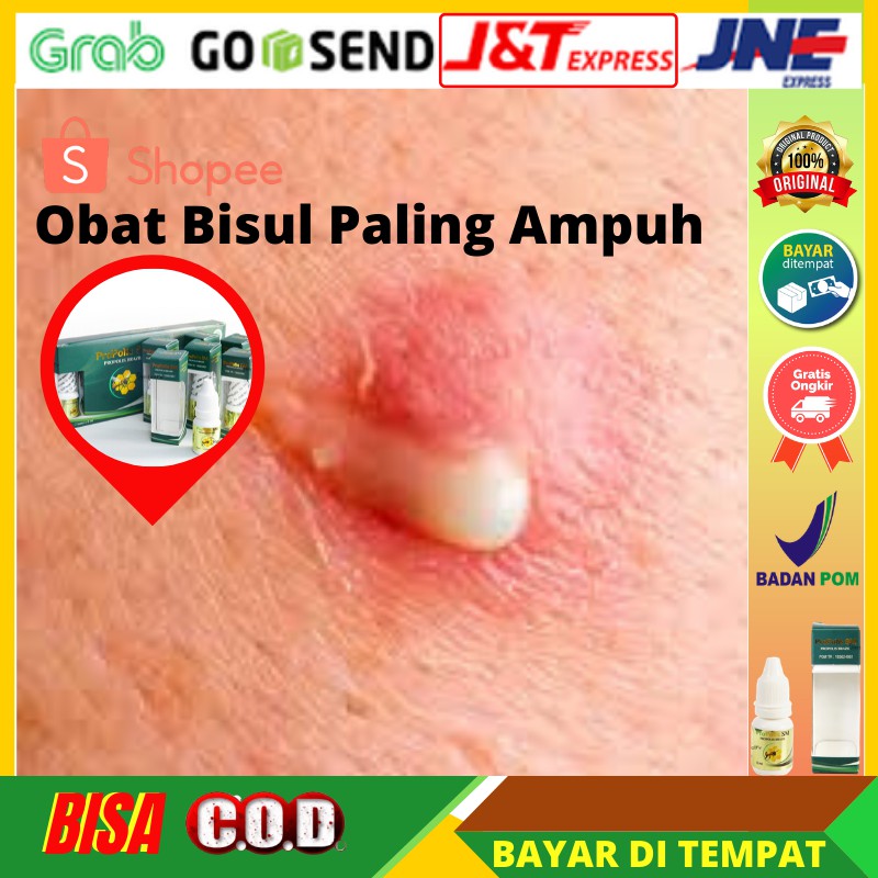 Obat Bisul, Bisul Item, Bisul Telor Kodok, Bisul Bayi PROPOLIS SM BRAZIL