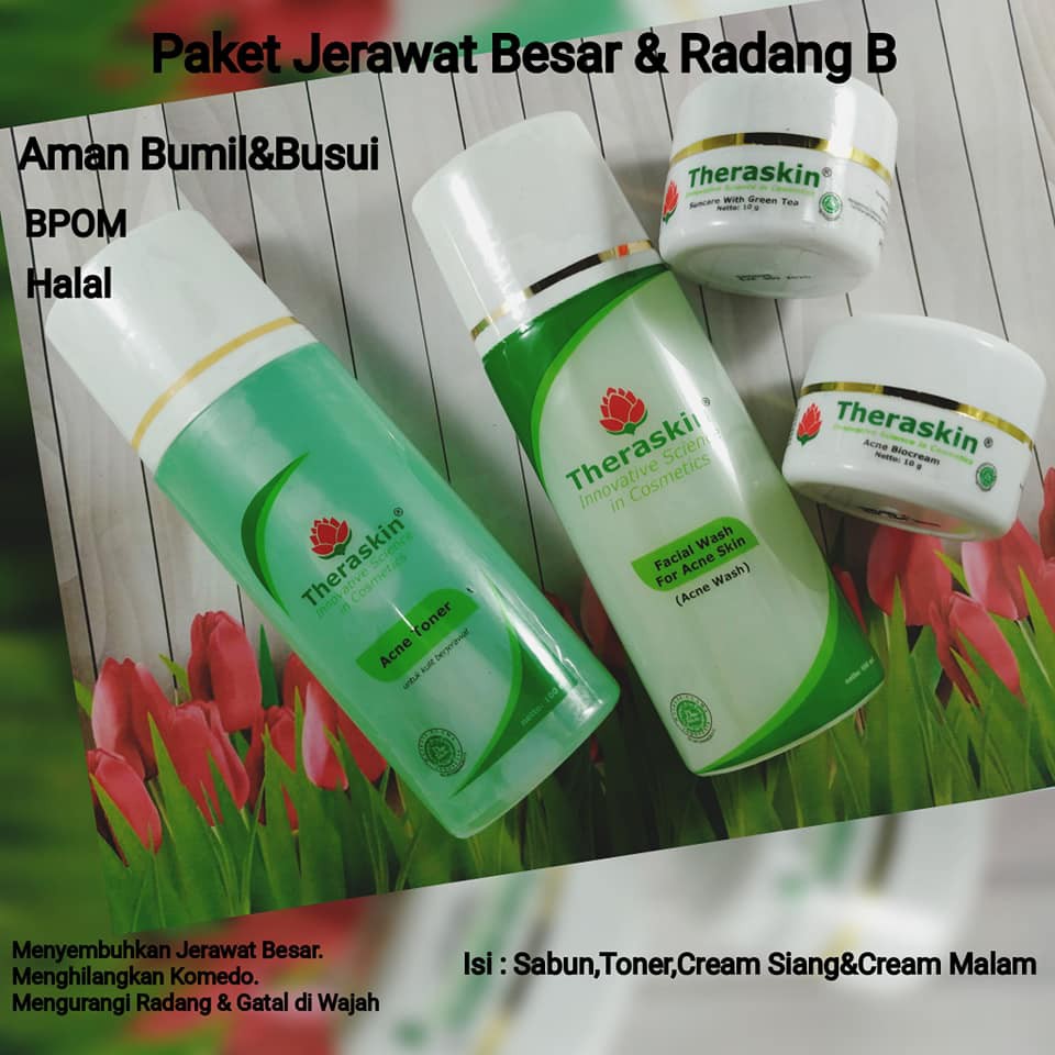 ACNE GLOW / ACNE SERIES /JERAWAT AMPUH/ THERASKIN ACNE / THERASKIN ACNE GLOW / THERASKIN ACNE WHITE
