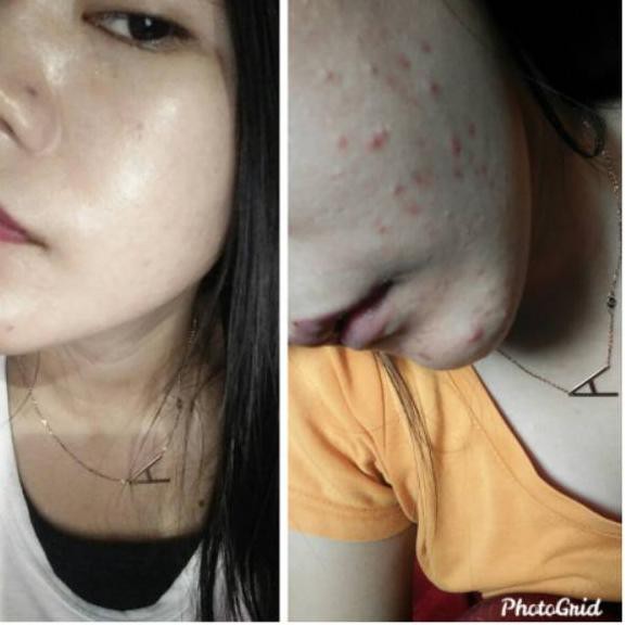 Stok terbaru toner beauty skin/toner RS ajaib pink 30 ml