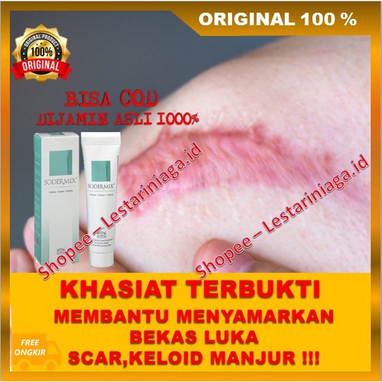 Sodermix Cream Menyamarkan Bekas Luka Scar Keloid Ruam Popok Ampuh ASLI
