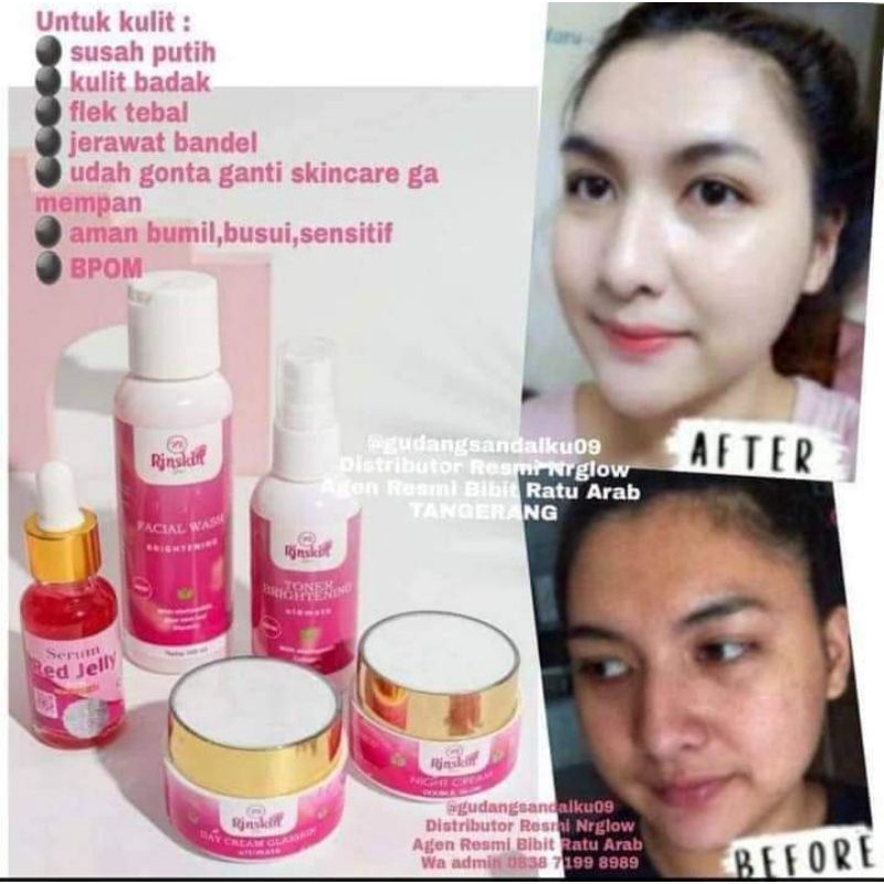 PAKET NR GLOW DOUBLE GLOW ACNE GLOW II ULTIMATE