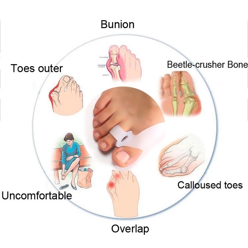 1 Pasang Bantalan Separator Jari Kaki Bahan Silikon Breathable Untuk Pereda Sakit / Korektor Bunion / Hallux Valgus