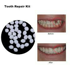 TEMPORARI TOOTH REPAIR PENAMBAL GIGI BERLUBANG