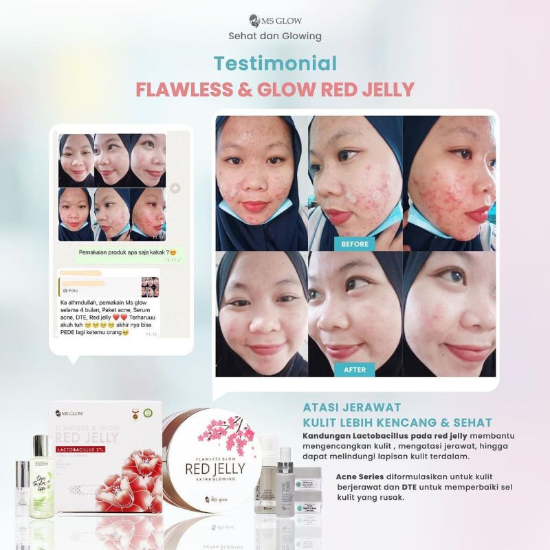 Paket Ultimate + Red Jelly Lactobacillus || MS GLOW