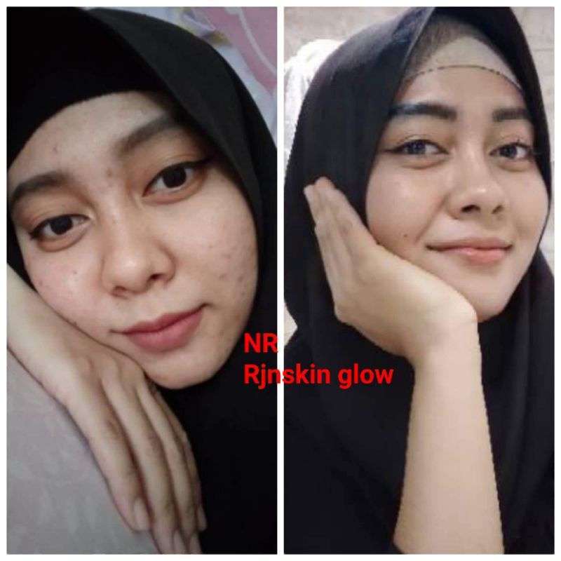 TONER BPOM NRGLOW RJNSKINGLOW PEMBERSIH WAJAH