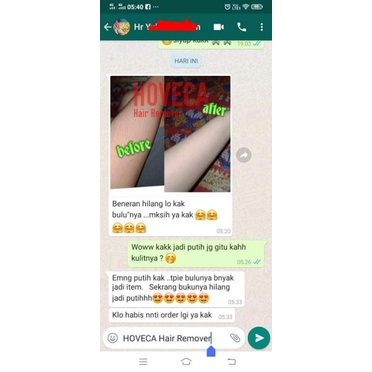 HOVECA Hair Removal SPRAY Permanen dan aman Perontok Penghilang Bulu Ketiak Miss V Kemaluan Missv Kaki Tangan Dada Remover