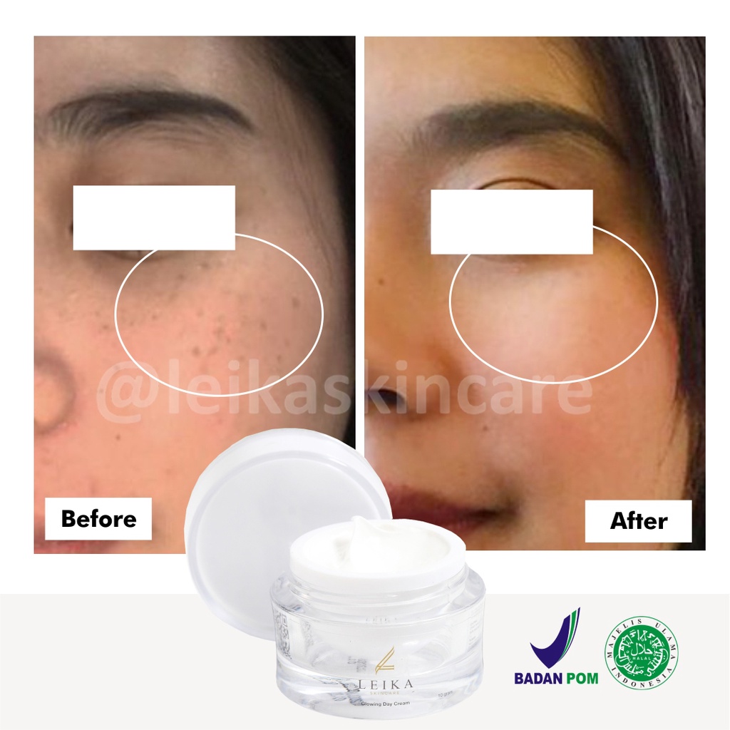 Ampuh Day Cream Penghilang Bintik Hitam Original Rekomendasi Perawatan Wajah BerBPOM Krim Siang Peng