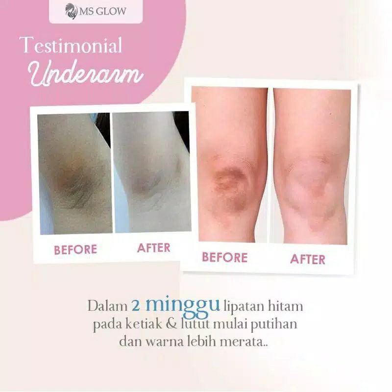 UNDERARM CREAM ORIGINAL by MS GLOW