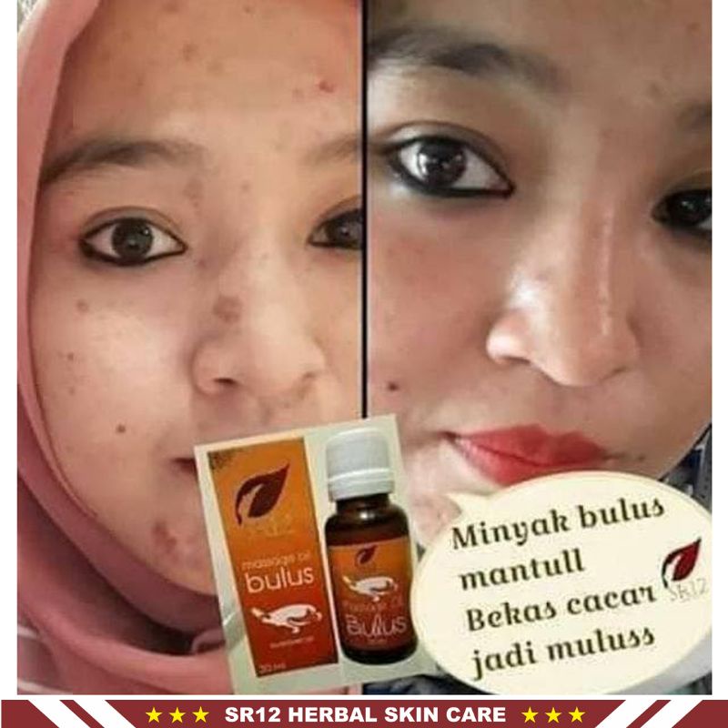 Minyak Bulus SR12 | Massage Oil Bulus SR12 Skincare | Perawatan Kulit | Minyak Pijat | Minyak Wajah | Sabun Bulus | Facial Wash Bulus