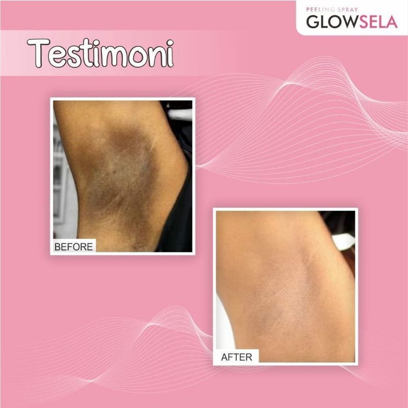 Pemutih ketiak selangkangan leher ampuh,dan murah glow sela 60 ml