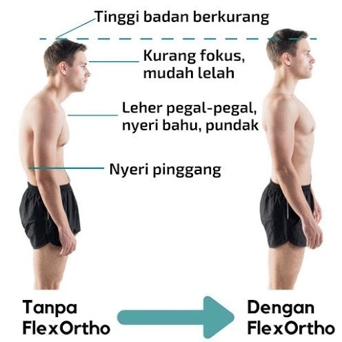 Flex Back Corrector atasi tulang punggung belakang