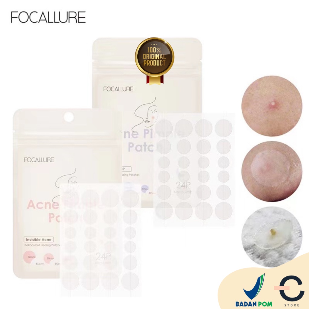 [ORI &amp; BPOM] FOCALLURE Spot Patch Acne Treatment Day | Night | Long-lasting Acne Nose &amp; Face Patch Mask | Pimple Patch | Skin care Acne Treatment Beauty Makeup FA186