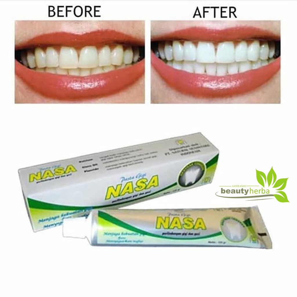 Pemutih Gigi Pasta Gigi Nasa Ori Menghilangkan Bau Mulut Dan Mengatasi Sakit Gigi Shopee Indonesia