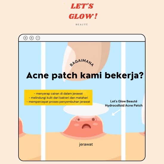 HYDROCOLLOID ACNE PIMPLE PATCH COLORFUL MURAH