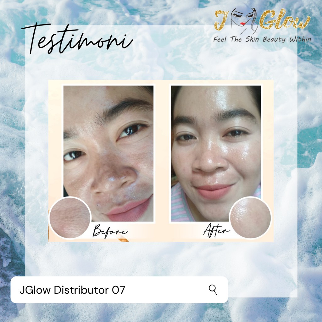 JGLOW Flek Melasma Hyperpigmentasi | Paket Perawatan Wajah Skincare BPOM-7