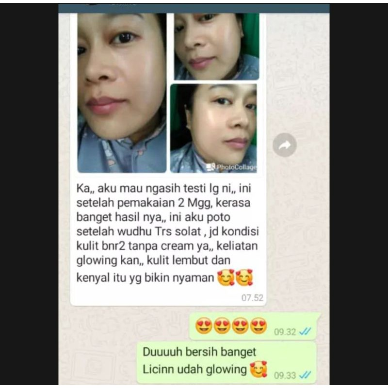 KUMPULAN Testimoni Pemutih Pelicin Wajah NRGLOW NR GLOW Original RJNSKIN