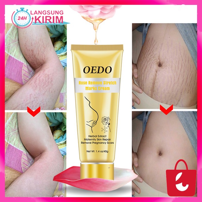 [Bisa COD] OEDO Rose Menghilangkan Stretch Mark Cream Nourish Pelembab Anti-Kerut Wanita Hamil