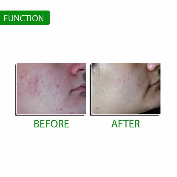 MASKER WAJAH WANITA-MASKER KOREA-BIOHERBAL ALOE VERA-PELEMBAB - KP2-172