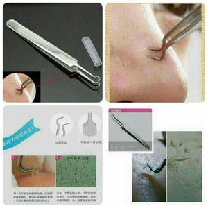 PINSET JEPIT PENCABUT KOMEDO JERAWAT / BLACKHEAD ACNE TWEEZER