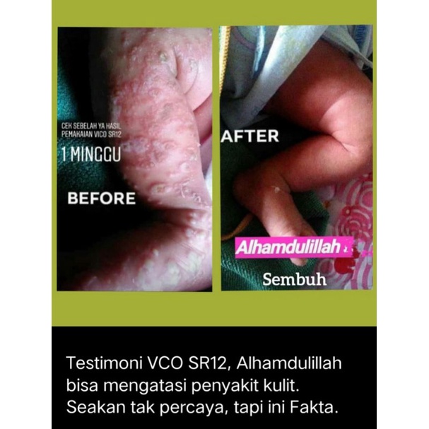 

VCO (Virgin Coconut Oil)